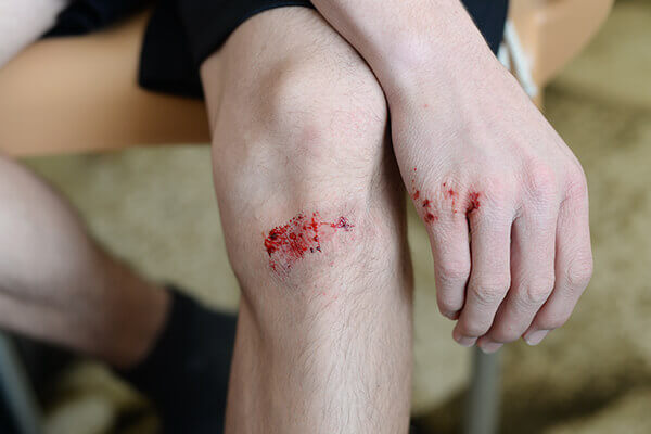 Heridas punzantes